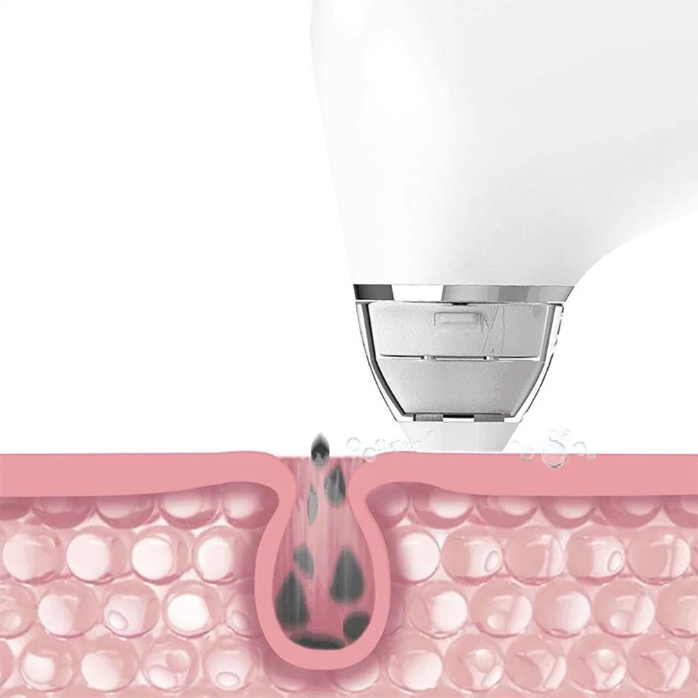 دستگاه میکرودرم پوست شیائومی مدل MI DOCO Pore Vacuum Cleaner Blackhead Remover BH003